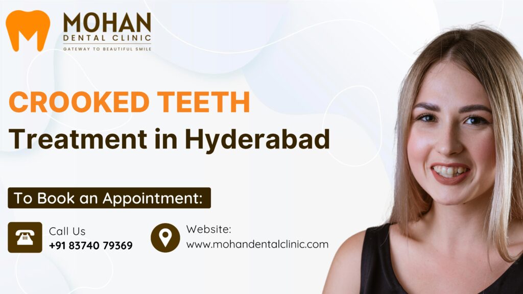 Crooked Teeth Treatment in Hyderabad