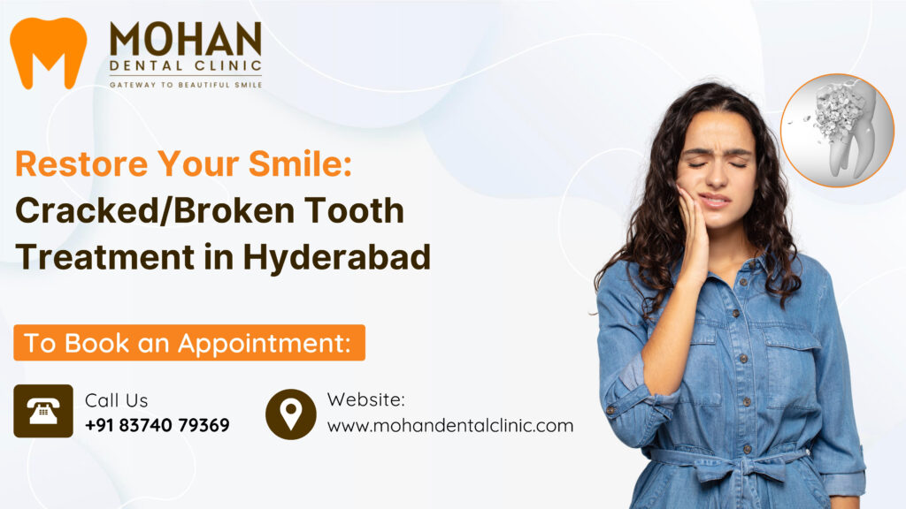 Cracked/Broken Tooth Treatment in Hyderabad