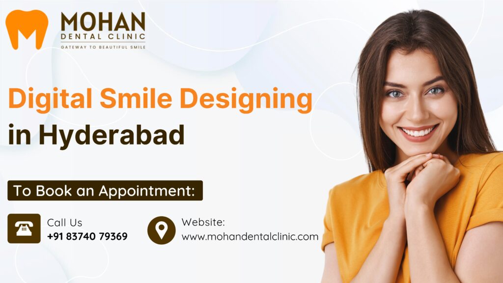  Digital Smile Designing in Hyderabad – Mohan Dental