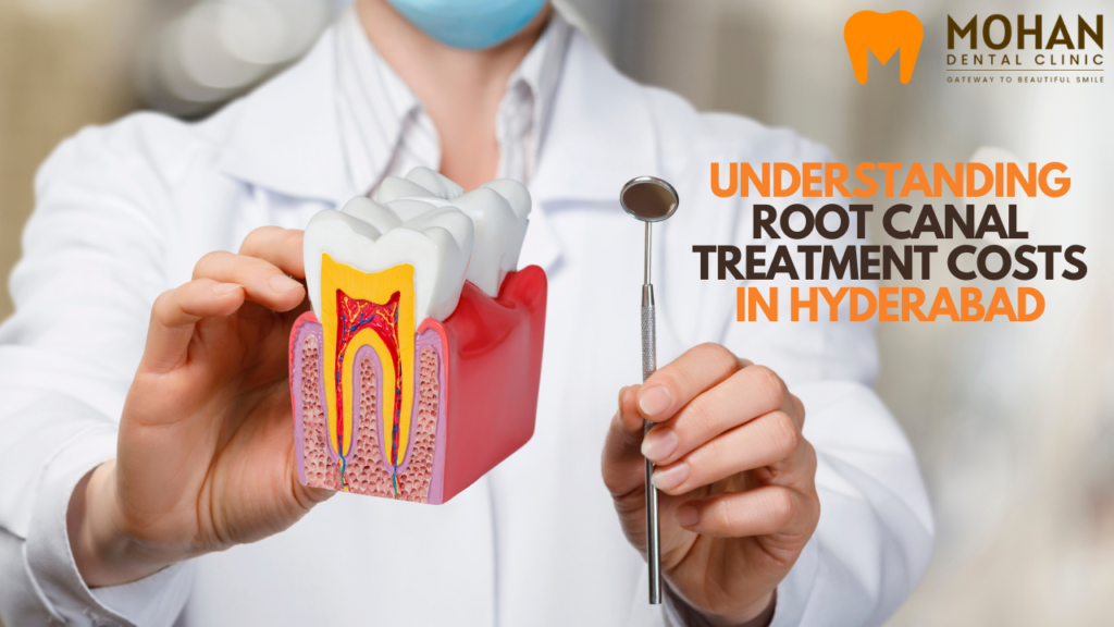 Understanding Root Canal Treatment Costs in Hyderabad - Mohan Dental