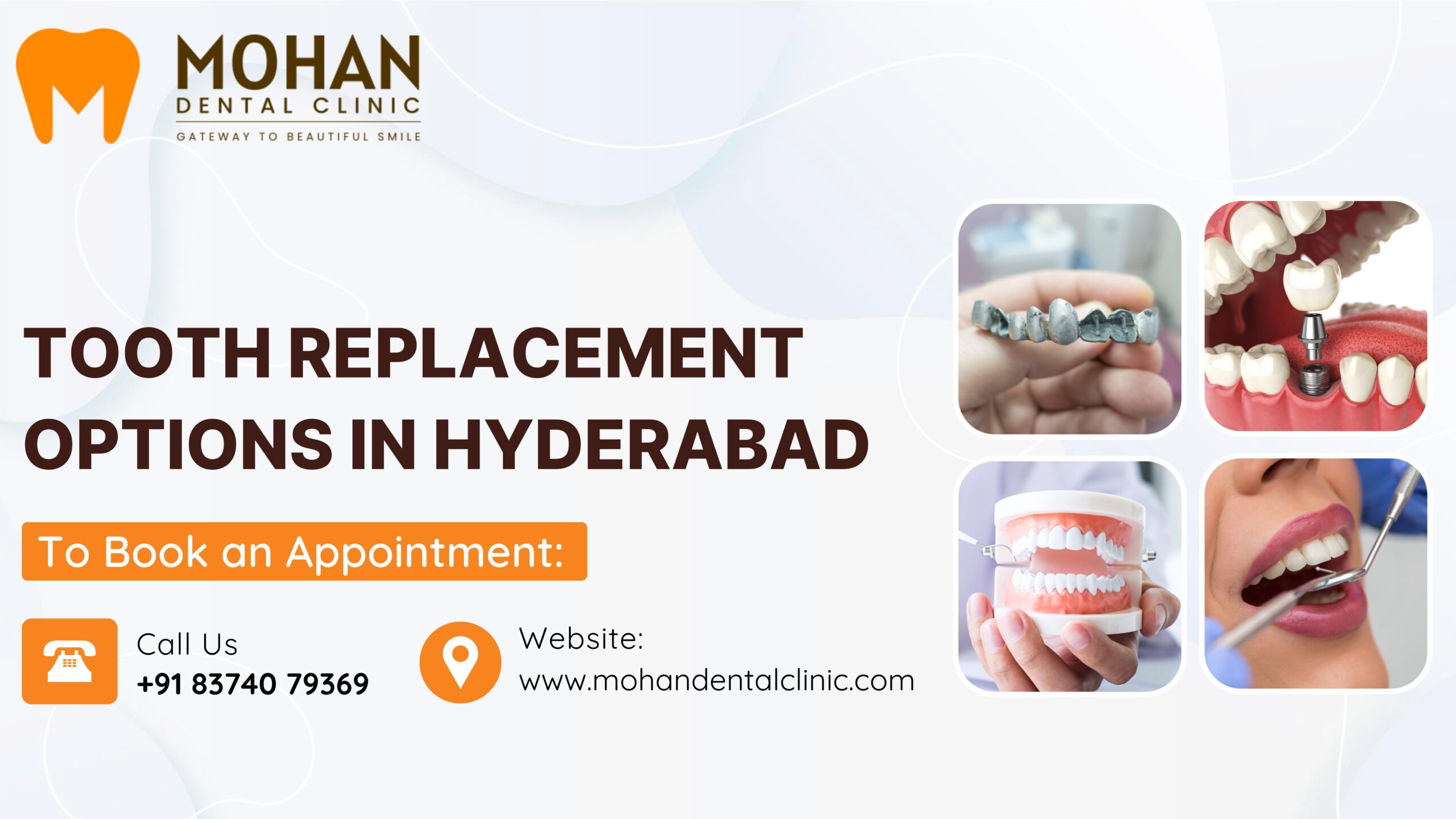 Options for Replacing Missing Teeth in Hyderabad