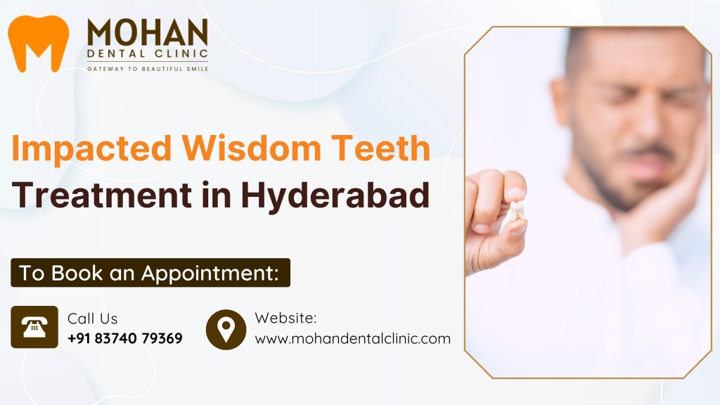 Impacted Wisdom Teeth Treatment in Hyderabad