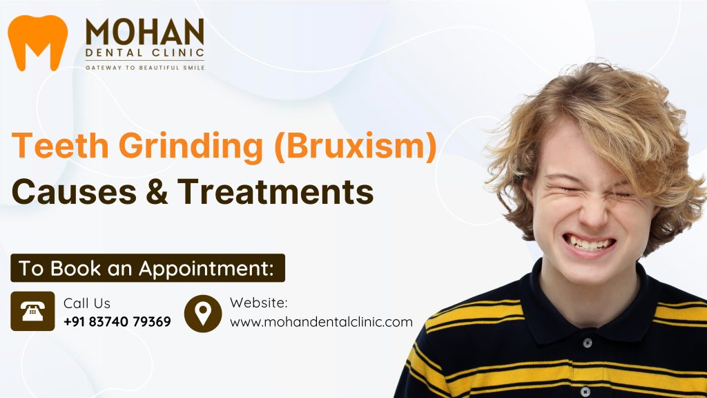 Teeth Grinding Treatment in Hyderabad