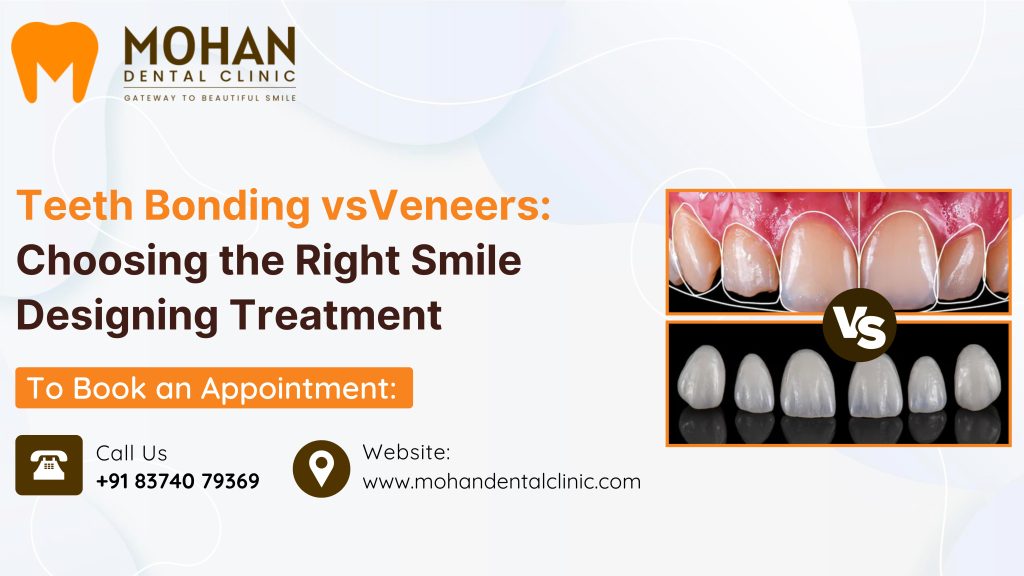 smile designing in Hyderabad