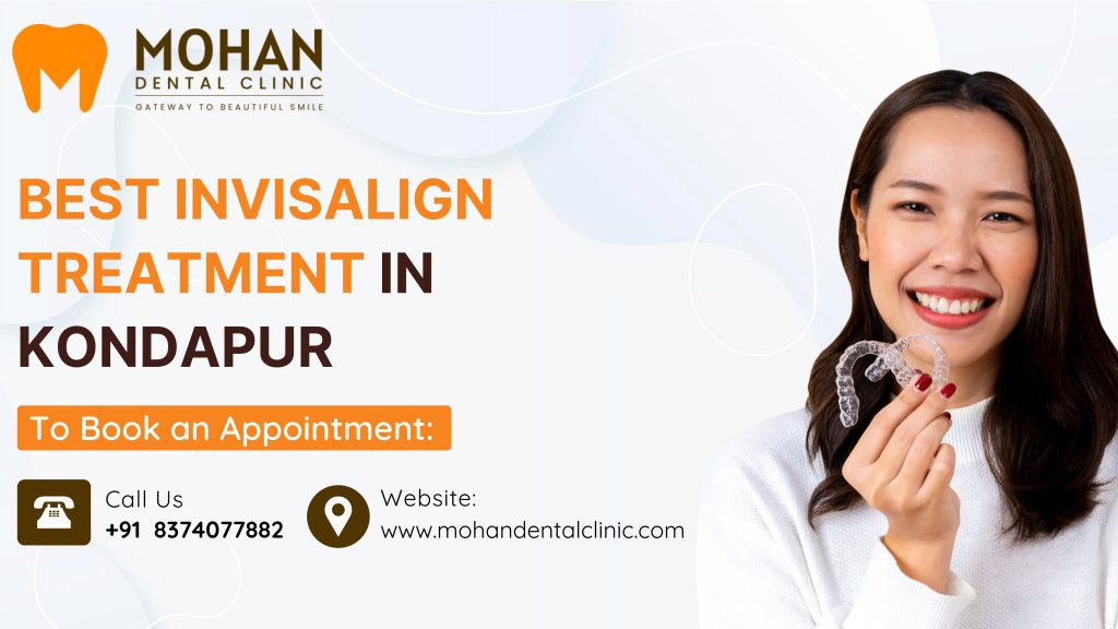 Best Invisalign Treatment in Kondapur