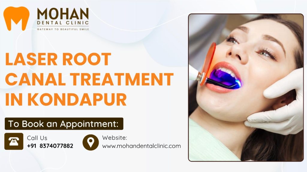 Laser Root Canal Treatment in Kondapur – Mohan Dental