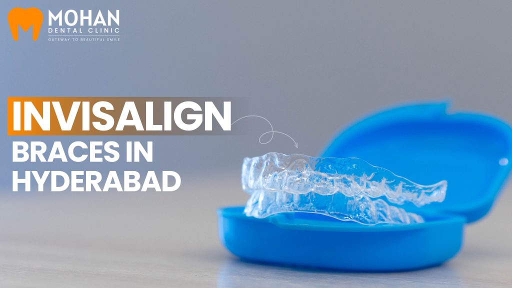 Invisalign Braces in Hyderabad