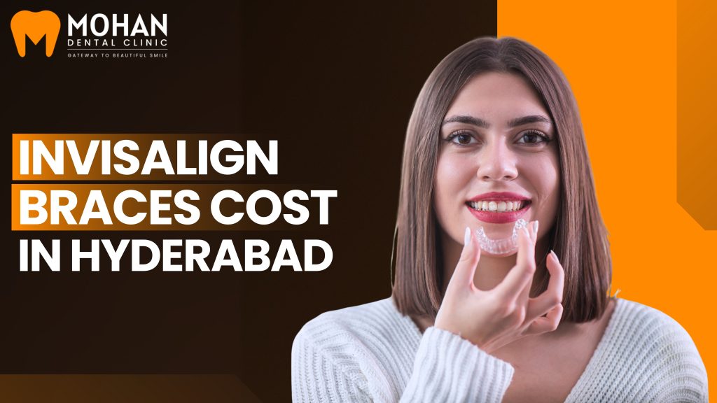 Invisalign Braces Cost in Hyderabad