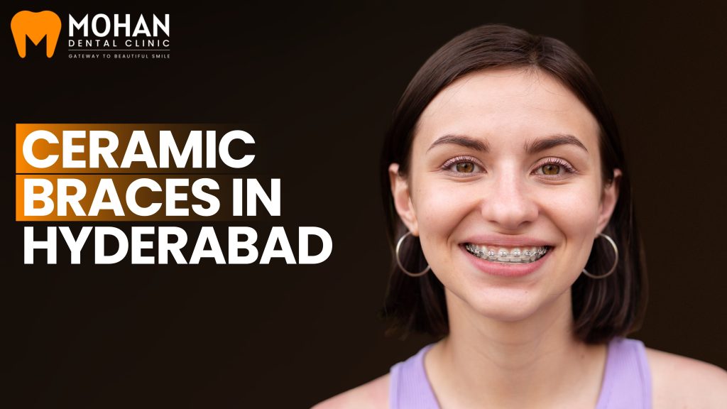 Ceramic Braces Treatment in Hyderabad